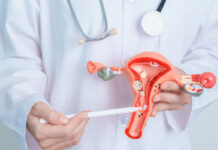 25% ਔਰਤਾਂ ਫਾਈਬਰੋਇਡਜ਼ ਤੋਂ ਪੀੜਤ, ਦੇਰ ਨਾਲ ਮਾਂ ਬਣਨਾ ਵੀ ਵੱਡਾ ਕਾਰਨ – ਡਾਕਟਰਾਂ ਨੇ ਦਿੱਤੇ ਰੋਕਥਾਮ ਦੇ ਤਰੀਕੇ