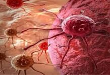 ਕੈਂਸਰ ਦੇ ਇਹ 5 ਲੱਛਣ ਸ਼ੁਰੂਆਤੀ ਹਾਲਤ ਵਿੱਚ ਹੀ ਨਜ਼ਰ ਆਉਂਦੇ ਹਨ; ਜੇ ਸਰੀਰ ਵਿੱਚ ਇਹ ਤਬਦੀਲੀਆਂ ਵੇਖੋ ਤਾਂ ਤੁਰੰਤ ਡਾਕਟਰ ਨਾਲ ਸੰਪਰਕ ਕਰੋ।