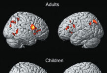 ਕੀ 32 ਸਾਲ ਦੀ ਉਮਰ ਵਿੱਚ ਦਿਮਾਗ ਪੂਰੀ ਤਰ੍ਹਾਂ ਮੈਚਿਓਰ ਹੋ ਜਾਂਦਾ ਹੈ? ਬਚਪਨ ਤੋਂ ਬੁੱਢਾਪੇ ਤੱਕ ਦਿਮਾਗ ਚਾਰ ਵੱਡੇ ਪੜਾਵਾਂ ਤੋਂ ਲੰਘਦਾ ਹੈ ਕੀ 32 ਸਾਲ ਦੀ ਉਮਰ ਵਿੱਚ ਦਿਮਾਗ ਪੂਰੀ ਤਰ੍ਹਾਂ ਮੈਚਿਓਰ ਹੋ ਜਾਂਦਾ ਹੈ? ਬਚਪਨ ਤੋਂ ਬੁੱਢਾਪੇ ਤੱਕ ਦਿਮਾਗ ਚਾਰ ਵੱਡੇ ਪੜਾਵਾਂ ਤੋਂ ਲੰਘਦਾ ਹੈ