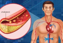 ਇੱਕ ਇੰਜੈਕਸ਼ਨ ਨਾਲ ਬੈਡ ਕੋਲੈਸਟ੍ਰੋਲ ਦਾ ਖ਼ਾਤਮਾ? ਗੇਮ-ਚੇਂਜਰ ਦਵਾਈ ਤਿਆਰ