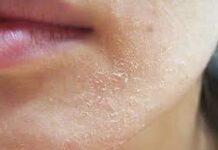 ਸਰਦੀਆਂ ‘ਚ ਡੱਲ ਸਕਿਨ ਨੂੰ ਕਹੋ ਅਲਵਿਦਾ! ਘਰੇਲੂ 4 ਕੁਦਰਤੀ ਫੇਸ ਸਕਰੱਬ ਨਾਲ ਪਾਓ ਨਰਮ ਤੇ ਚਮਕਦਾਰ ਚਮੜੀ ਸਰਦੀਆਂ 'ਚ ਡੱਲ ਸਕਿਨ ਨੂੰ ਕਹੋ ਅਲਵਿਦਾ! ਘਰੇਲੂ 4 ਕੁਦਰਤੀ ਫੇਸ ਸਕਰੱਬ ਨਾਲ ਪਾਓ ਨਰਮ ਤੇ ਚਮਕਦਾਰ ਚਮੜੀ