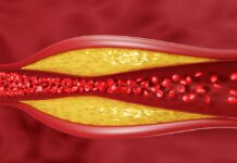 ਸਿਰਫ਼ ਬਲੱਡ ਟੈਸਟ ਹੀ ਨਹੀਂ, ਚਿਹਰਾ ਵੀ ਦੱਸਦਾ ਹੈ ਕੋਲੈਸਟ੍ਰੋਲ ਦਾ ਹਾਲ; ਇਹ 4 ਸੰਕੇਤ ਨਜ਼ਰਅੰਦਾਜ਼ ਨਾ ਕਰੋ