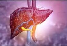 ਦੁਨੀਆ ਭਰ ਵਿੱਚ ਵੱਧ ਰਹੀਆਂ ਲਿਵਰ ਬਿਮਾਰੀਆਂ, 2050 ਤੱਕ 2 ਅਰਬ ਲੋਕ ਹੋ ਸਕਦੇ ਪ੍ਰਭਾਵਿਤ: ਰਿਪੋਰਟ